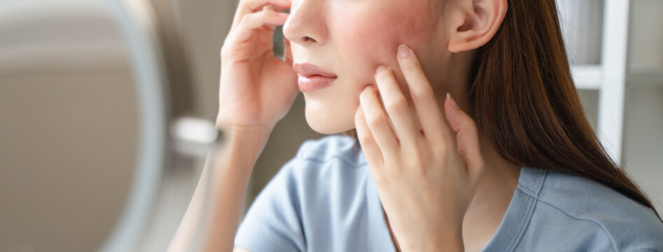 Sensitive skin with cosmetology, Asian young woman looking at red spot on her face from cosmetic allergy in the mirror.