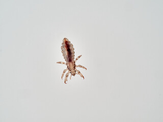 Head lice. Pediculus humanus. Human louse on a white background on a human hair.
