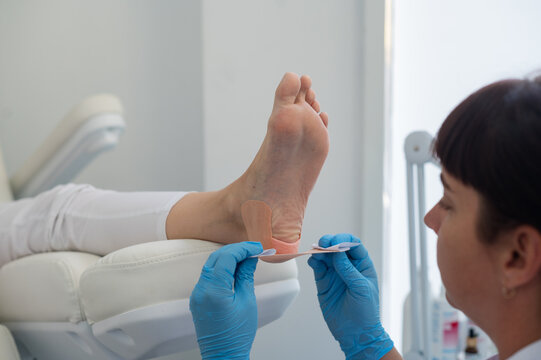 A podologist wearing gloves glues a special relief corn patch on the heel of the patient. Patient on medical pedicure procedure, visiting podiatrist. Peeling feet. Foot treatment in SPA salon.Podiatry