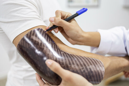 Specialist Customizing a Carbon Fiber Elbow Brace for Patient