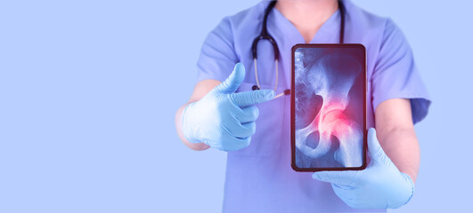 Doctor shows x-ray of pelvis through tablet. Concept of pain and discomfort in femoral head. Doctor...