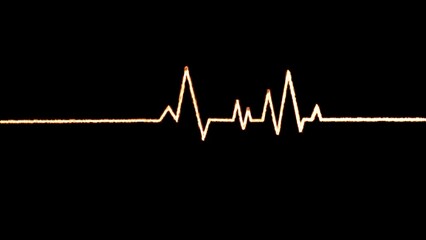 Illustration ECG Heartbeat Display. 