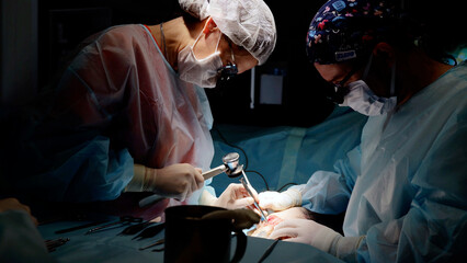 Skilled surgeons perform delicate operation in dimly lit room, showcasing teamwork and precision in healthcare