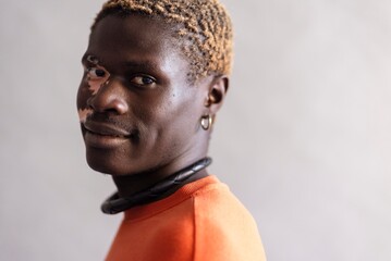 A close-up portrait of a man with vitiligo, wearing an orange sweatshirt and accessorized with a necklace and earrings