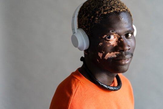 A man with vitiligo in an orange sweatshirt wears headphones and looks to the side with a calm expression, enjoying a quiet moment of music appreciation in a modern indoor setting