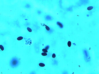 Microscopic View of Spores in Blue Background