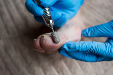 Professional hardware pedicure, elderly woman with cracked skin on her foot at a podiatrist's appointment, chiropody and podology concept