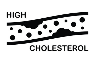 High blood cholesterol icon with a arteriosclerosis risk. Clogged artery. Concept of high cholesterol and unhealthy lifestyle, fast food. thrombosis microvascular disease. Vector illustration symbol.