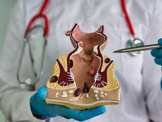 Medical professional demonstrates anatomical model of the human nasal cavity during a consultation...