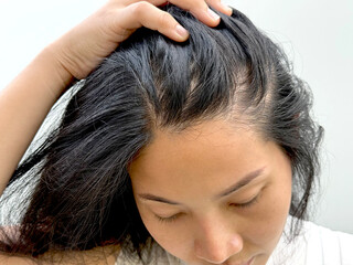 Naklejka premium Women with hair loss dryness and frizziness