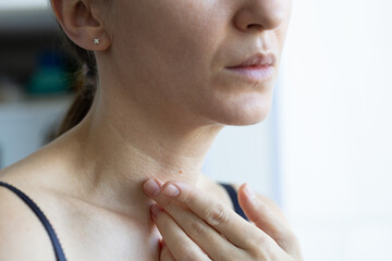 Woman touching wrinkles on her neck, closeup. Skin aging.