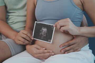 The hands of the pregnant parents hold the seven-month pregnant mother's belly to show the results of the fetal examination in the womb.
