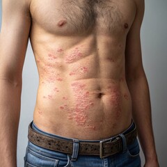 Naklejka premium man with skin disease
