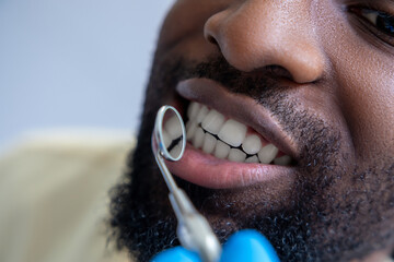 Male dentist in modern dental office examining African American patient’s teeth with mirror and dental tools