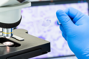Scientist wear blue glove holding parafin human tissue block and out of focus microscope and computer monitor show glandular image.Medical patholology and cytology laboratory technology concept.