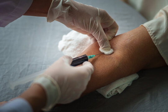Close up of doctor or nurse taking a blood sample from arm vein with vacutainer. syringe to venipuncture the patient