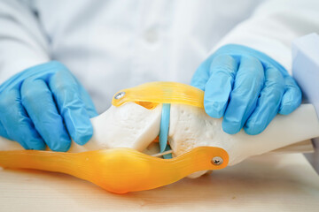 Knee osteoarthritis, Doctor showing model knee joint orthopedic.