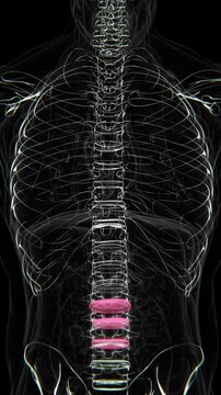 Disc Bulging of L4 L5 and L6 Indication in X-Ray video | sciatica disc animation video in vertical format | sciatica disc Indication video