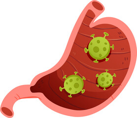 Various types of stomach with sickness