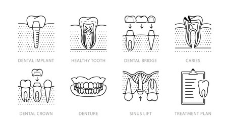 Dentistry, line icon set. Dental implant, tooth, caries, dental bridge, crown, dentures, sinus lift. Dentistry and teeth care topic. Oral surgery. Linear illustration, editable stroke icon