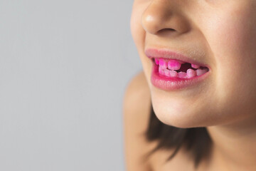 Close up of 7 year old girl's teeth with pink plaque indicator solution applied to teeth, concept of dental hygiene and health. copy space