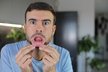 Man showing his oral mucosa 