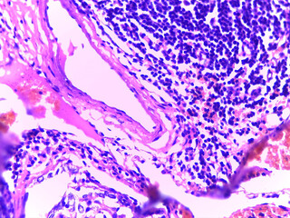 Microscopic Tissue Analysis