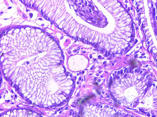 Microscopic View of Glandular Tissue