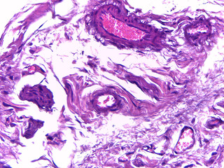 Microscopic Tissue Analysis with Purple Staining