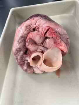 human heart dissection