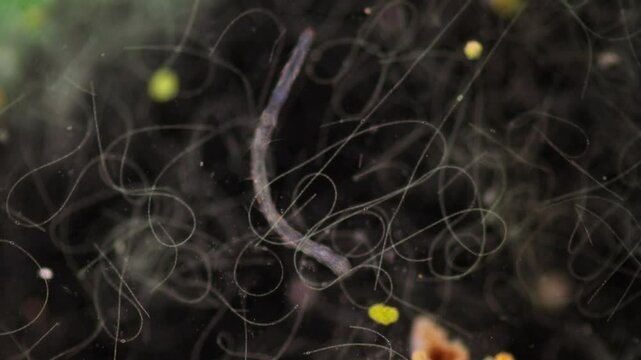 Methods of study of Protozoa, Algae and bacteria under the microscope in the biology laboratory.