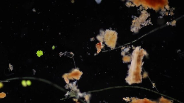 Methods of study of Protozoa, Algae and bacteria under the microscope in the biology laboratory.