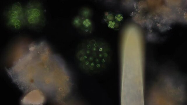 Methods of study of Protozoa, Algae and bacteria under the microscope in the biology laboratory.