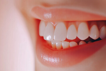 Fototapeta premium Female smile with lip filler. Open mouth with perfect teeth. Dental care, whitening healthy procedure, orthodontic treatment. Fashion cosmetic concept. Sensual beauty banner with copy space