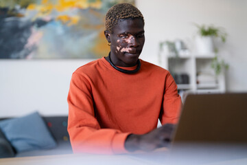A young man with vitiligo dressed in an orange shirt types on a laptop while seated at a desk in a bright office with modern furniture and artwork, surrounded by a relaxed and professional atmosphere.