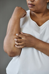Vertical close up of African American woman scratching arms and elbows suffering from skin...