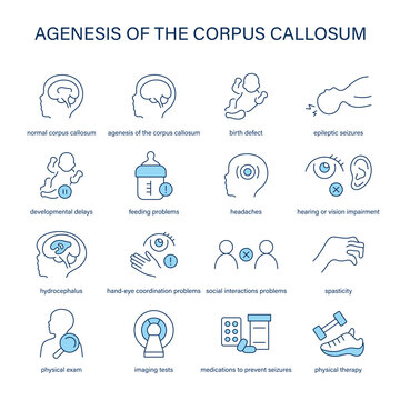Agenesis of the Corpus Callosum symptoms, diagnostic and treatment vector icon set. Medical icons.