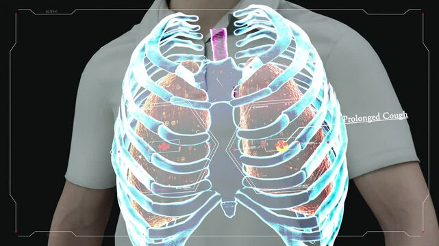 Advanced AI in Tuberculosis Imaging: Early Detection and Drug Resistance Prediction 3d rendering