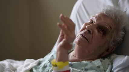 An elderly woman with a black eye and a bandage on her hand lies in a hospital bed, looking up with a pained expression. Her skin is wrinkled and pale, suggesting a long stay in the hospital.
