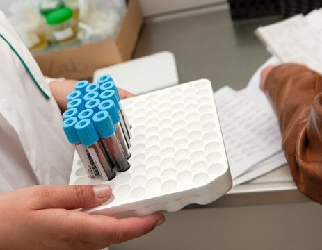 Blood samples. Blood testing and reserch in hospital