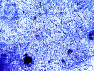 Microscopic View of Crystalline Structures