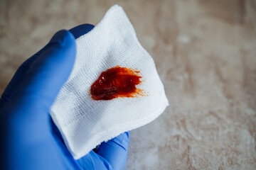 This is an intimate and closeup view of a bloodstained wipe that is being held by a gloved hand...