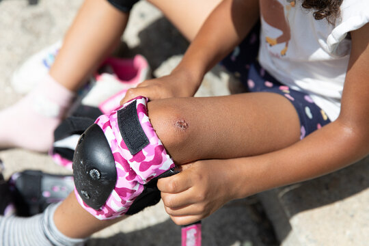 Young girl putting a knee pad over her bruised knee before skating