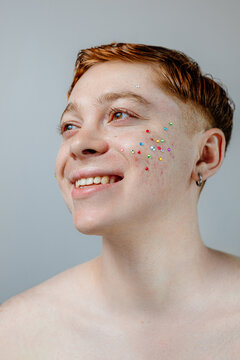 A guy with acne and pimples with rhinestones on his face