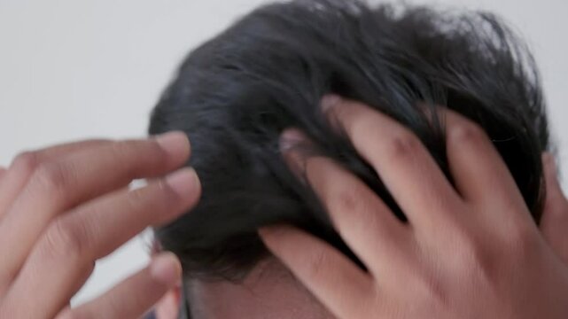 Hair loss, hair thinning, alopecia. Man touching his thinning hair on scalp.