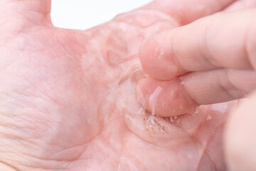 手のひらにのせた透明なジェルのクローズアップ