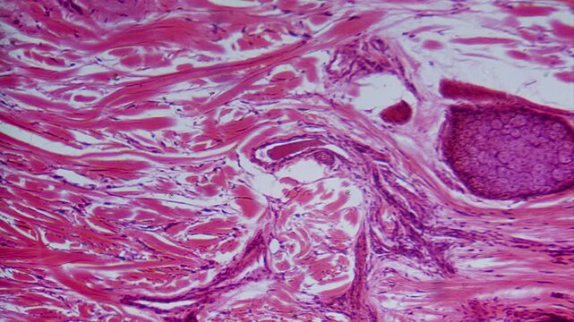 Stained skin section with hair follicle microscope view