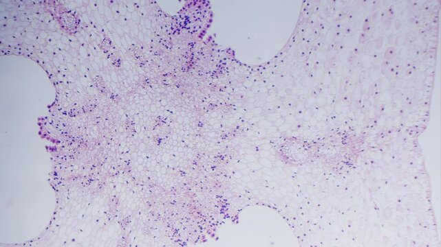 Ovary of lilium transverse section, stained, under microscope bright field view