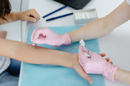 Doctor doing skin allergy test at white table in office. Allergy test - skin prick allergy testing for possible allergens