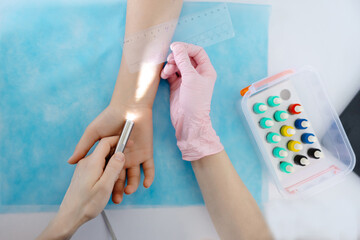 Doctor doing skin allergy test at white table in office. Immunology doctor is measuring allergy...